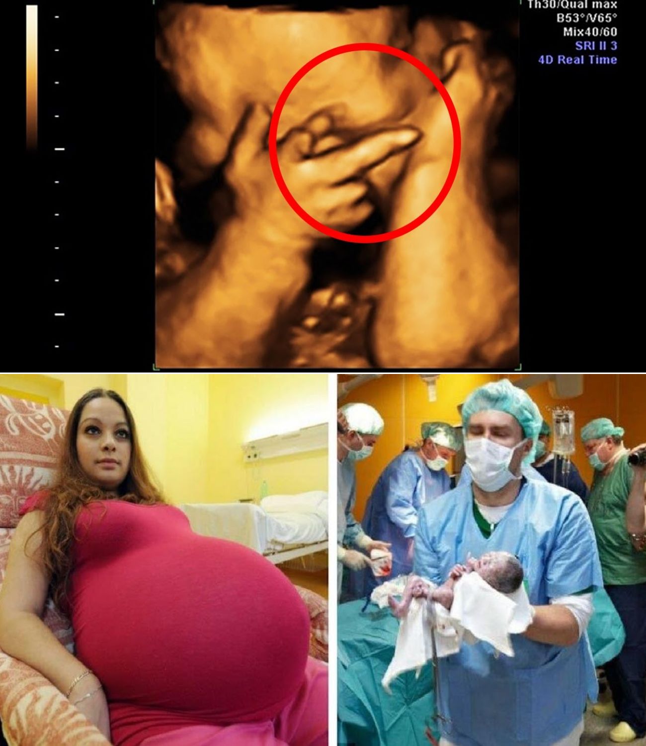 Mor tror hun er gravid med tvillinger, lægen fryser til, da han ser hendes ultralydsscanning